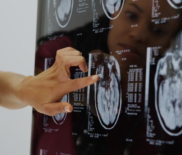 xray screen results provider review